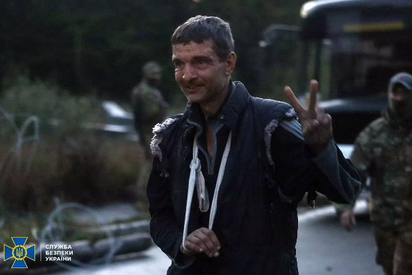 ரஷ்யாவிடம் கைதியாக சிக்கிய உக்ரைன் வீரரின் தற்போதைய பரிதாப நிலை! அதிர்ச்சி தரும் புகைப்படம் | Soldier Released Russians Torture Shocking Photos