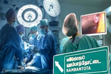 பெண்ணின் கருப்பையிலிருந்து அகற்றப்பட்ட 15 கிலோ கட்டி : இலங்கை மருத்துவர்கள் சாதனை