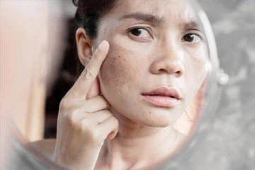 கருமை நிறத்தை போக்க வேண்டுமா... கிரீம்களுக்கு பதிலாக இதை பயன்படுத்துங்கள் உடனடிபலன்