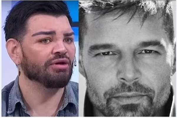 அந்த பாடகரை போல் மாறனும் - 30க்கும் மேற்பட்ட ஆபரேஷன் செய்த இளைஞர்! | Argentina Man Surgeries Like Singer Ricky Martin