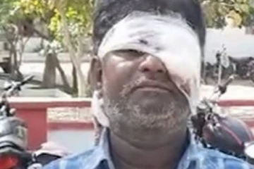 டிவி பார்ப்பதில் ஏற்பட்ட தகராறு... கணவரை கொடூரமாக தாக்கிய மனைவி