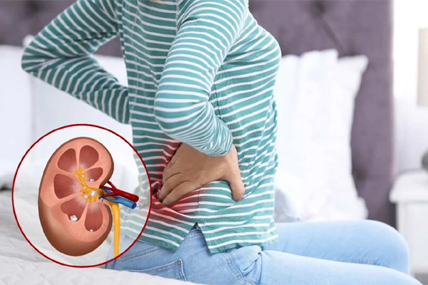 Kidney Stone: சிறுநீரக கற்களால் அவதிப்படுறீங்களா? எளிதாக கரைக்கும் உணவுகள் இதோ | Foods Use To Dissolve Kidney Stone Kidney Stone: சிறுநீரக கற்களால் அவதிப்படுறீங்களா? எளிதாக கரைக்கும் உணவுகள் இதோ | Foods Use To Dissolve Kidney Stone