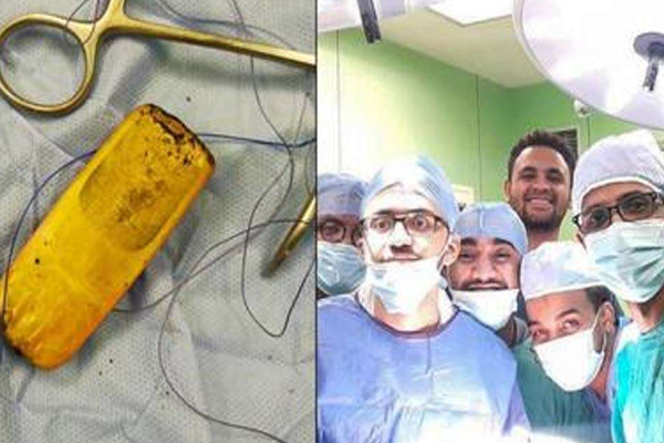 6 மாதமாக  வயிற்றில் செல்போனுடன்  உலா வந்த நபர்! மருத்துவர்கள் அதிர்ச்சி | Person Around Cell Phonestomach For 6 Months