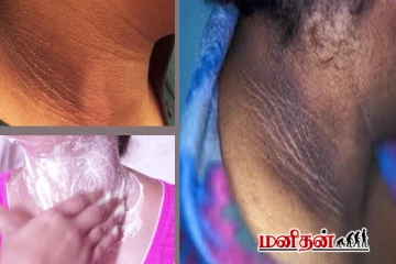 அடர்த்தியான கழுத்து கருப்பா? தயிருடன் இதை சேர்த்து பூசுங்க