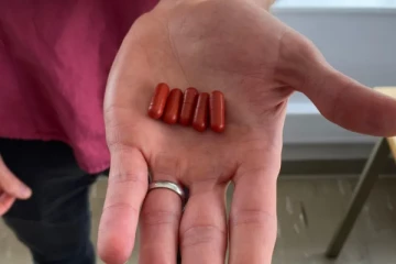 Superbug கிருமிகளை ஒழிக்க மனித மலத்தை பயன்படுத்தும் சோதனை முயற்சி