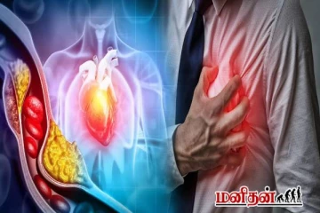 கொலஸ்ட்ரால் அதிகரிப்பதற்கான காரணங்கள் என்ன... எப்படி கட்டுப்படுத்துவது?