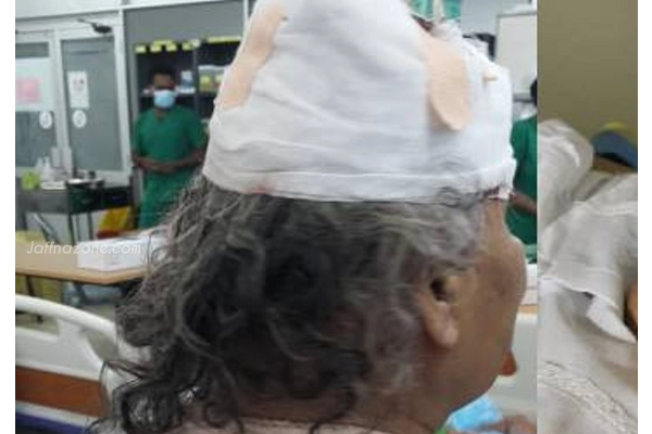 வயோதிப பெண்ணை சுத்தியலால் தாக்கி நகைகளை சுருட்டி சென்ற கொள்ளையர்கள்! | Thieves Attacked An Elderly Woman With A Hammer