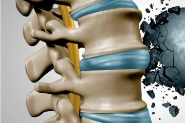 100 வயசுக்கு மேல ஆனாலும் எலும்பை உறுதியாகவே வச்சிக்கணுமா? இதை சாப்பிடுங்க