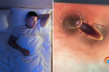 தொண்டை குழியில் சிக்கிய கரப்பான் பூச்சி: 58 வயது முதியவருக்கு காத்திருந்த அதிர்ச்சி!