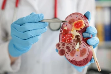 சிறுநீரக கற்களால் அவதிப்படுகிறீர்களா? ஆரம்பத்திலேயே சுலபமாக தடுக்கலாம்