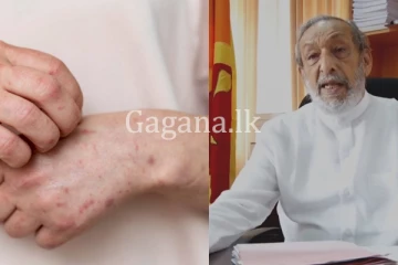 මෙරට ඒඩ්ස් ආසාදනය 13%කින් ඉහළට.