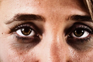 கருவளைய பிரச்சினையால் கஷ்டப்படுகிறீர்களா? இந்த பேக் மட்டும் போடுங்க!