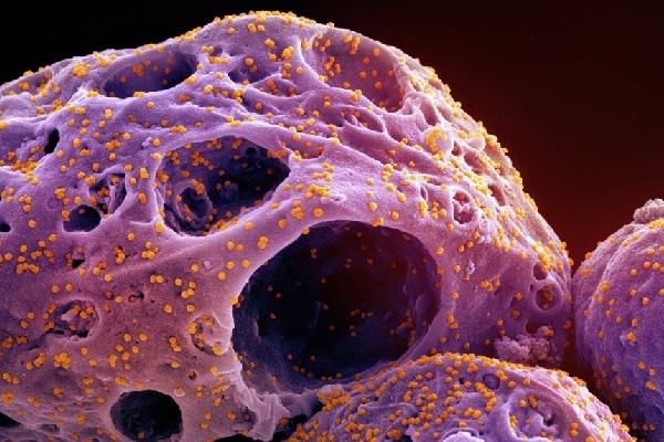 கனடிய மக்களின் ஆயுட்காலத்தில் ஏற்பட்டுள்ள மாற்றம் | Mortality Rose In 2021 Led By Cancer Heart Disease