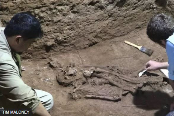 ஆதிமனிதன் வரலாறு: 31,000 ஆண்டுக்கு முன்பே உறுப்பு நீக்க அறுவைச் சிகிச்சை செய்த குகை மனிதன் | Caveman Who Underwent Amputation Surgery