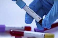 லிந்துலை சுகாதார பிரிவில் 10 பேருக்கு கொரோனா தொற்று உறுதி