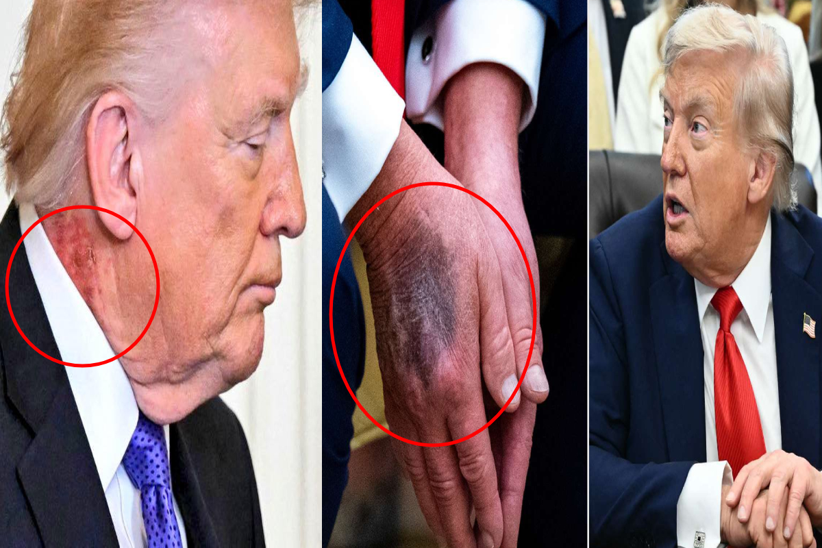 சர்ச்சையை கிளப்பும் டிரம்ப் புகைப்படம்; நோயால் பாதிப்பா! | Trump Pics Sparks Controversy Is It Due To Illness சர்ச்சையை கிளப்பும் டிரம்ப் புகைப்படம்; நோயால் பாதிப்பா! | Trump Pics Sparks Controversy Is It Due To Illness