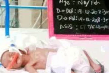 வெறும் 875 கிராமுடன் பிறந்த குழந்தை: காப்பாற்றிய மருத்துவர்களுக்கு குவியும் பாராட்டுகள்