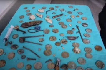 வயிற்றை டூல்ஸ் பாக்ஸாக மாற்றிய நபர்; அதிர்ச்சியில் மருத்துவர்!