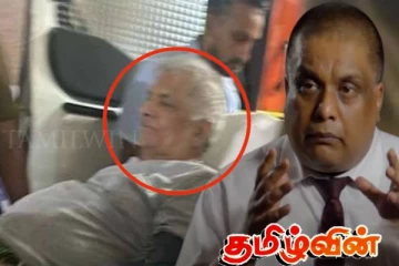 வருவதை மட்டுப்படுத்துங்கள்! ரணிலின் வைத்தியர் விடுத்த எச்சரிக்கை