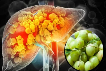 கொழுப்பு கல்லீரலால் பாதிக்கப்பட்டவரா நீங்கள்? இந்த உணவுகளை கட்டாயம் உண்ணுங்கள்