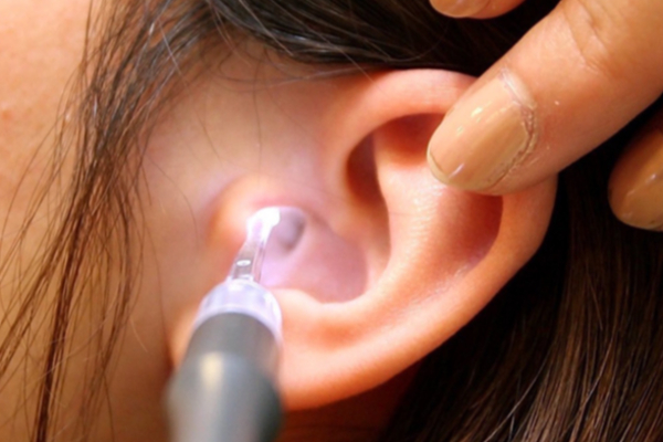 காதில் பட்ஸ் வைத்து சுத்தம் செய்பவரா நீங்கள்? இனி அந்த தவறை செய்திடாதீங்க | Ear Infection Symptoms In Tamil