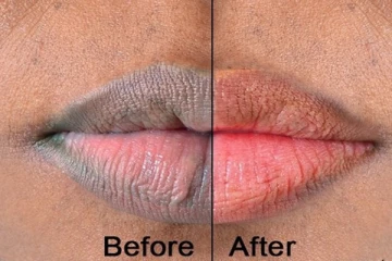 உங்களுடைய உதடு கருமையாவதற்கு காரணம் இது தான் - கட்டாயம் அறியவும்