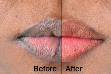 ஒரே நாளில் கருப்பான உதட்டை சிவப்பாக மாற்றும் எளிய முறை - கட்டாயம் தெரிஞ்சிக்கோங்க