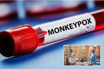 இந்தியாவில் முதல் குரங்கம்மை இறப்பு? அவசர நிலையில் கேரளா சுகாதாரத் துறை