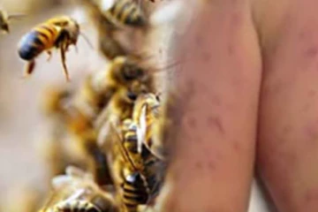 පාසල් සිසුන් පිරිසකට බඹර ප්‍රහාරයක්.