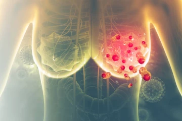 කාන්තා සහ පිරිමි පියයුරු පිළිකා වල රෝග ලක්ෂණ.