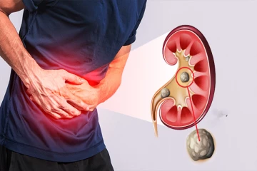 காலையில் இந்த அறிகுறிகளை அலட்சியப்படுத்தாதீங்க... சிறுநீரக கல் பிரச்சனையாக கூட இருக்கலாம்