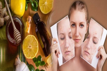 செலவே இல்லாம முகப்பருவுக்கு முடிவு கட்டணுமா? இந்த வீட்டு வைத்தியம் போதும்!