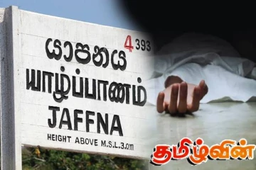 யாழில் பித்தப்பை சத்திர சிகிச்சை மேற்கொள்ளப்பட்ட பெண் பலி