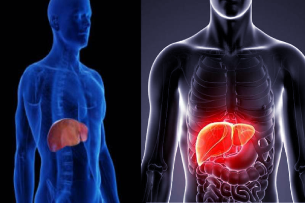 90 நாட்களில் கொழுப்பு கல்லீரலை எப்படி இல்லாமல் செய்யலாம்? | 90 Day Habit To Prevent Fatty Liver Health Benefit