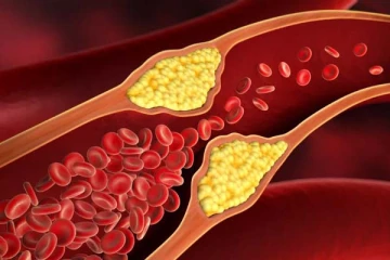 இந்த உணவுகளை அதிகம் எடுத்துக்காதீங்க... ரத்த குழாயில் அடைப்பு ஏற்படுமாம்