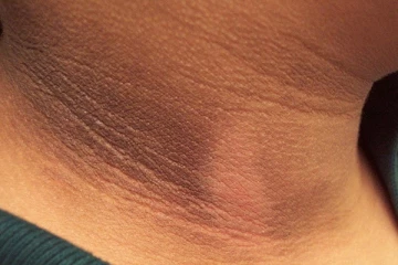 கழுத்து பகுதியில் உள்ள கருமை உங்கள் அழகை கெடுக்கிறதா? அதனை போக்க இதோ சூப்பரான 5 டிப்ஸ்