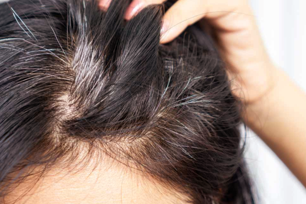 இனி ரசாயன முடி சாயம் வேண்டாம் - இந்த 4 பொருளில் 30 நிமிடத்தில் முடியை கருப்பாக்கலாம் | How To Make Natural Hair Dye Home Remedy