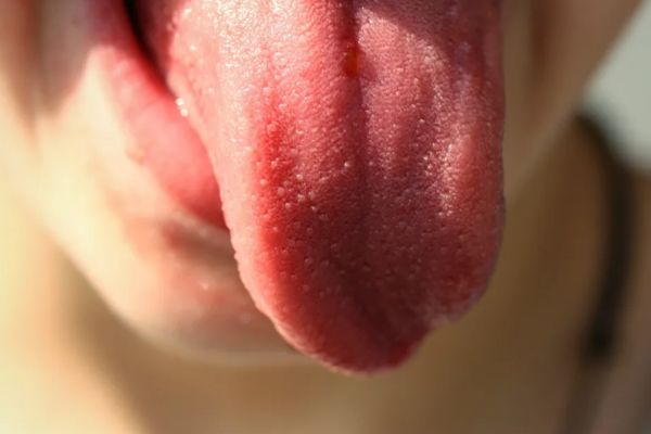 குடும்ப தகராறில் கணவனின் நாக்கை கடித்து விழுங்கிய மனைவி! | Wife Bites Off Husband S Tongue Bihar