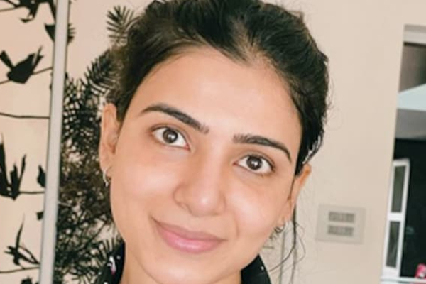 நடிகை சமந்தாவுக்கு அரிய வகை தோல் நோயா? ஷாக்கில் ரசிகர்கள் - காட்டுத் தீயாய் பரவும் தகவலின் பின்னணி | Samantha Ruth Rep Dismisses Rumours