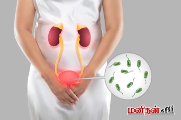 சிறுநீர் பாதை தொற்றை குணப்படுத்தணுமா? இதை Follow பண்ணுங்க