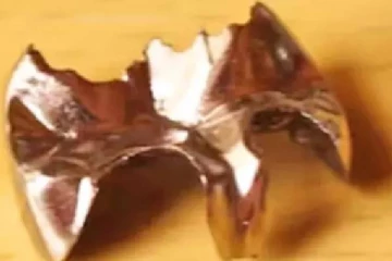 மருத்துவமனையில் பற்களை திருடி.. கோடிக்கணக்கில் சம்பாதித்த மருத்துவர்