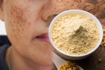 முகத்தில் உள்ள கரும்புள்ளிகளை நீக்க உதவும் கடலை மாவு: எப்படி பயன்படுத்துவது?