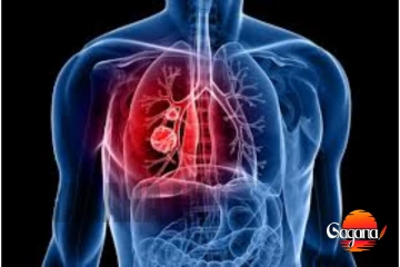 මාරාන්තික ලෙඩක් ලංකාව තුල ශීඝ්‍ර ලෙස වර්ධනයක්