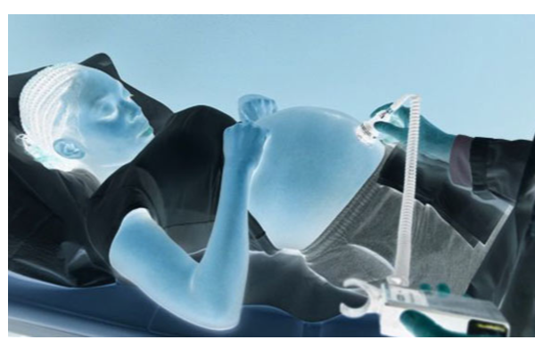 11 வயதில் குழந்தையை பெற்றெடுத்த சிறுமி : பெற்றோர்கள் பேரதிர்ச்சி! | World 11 வயதில் குழந்தையை பெற்றெடுத்த சிறுமி : பெற்றோர்கள் பேரதிர்ச்சி! | World