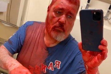 ரஷ்யாவில் அமைதிக்கான நோபல் பரிசு பெற்றவர் மீது வண்ணப்பூச்சி ஊற்றி தாக்குதல்!