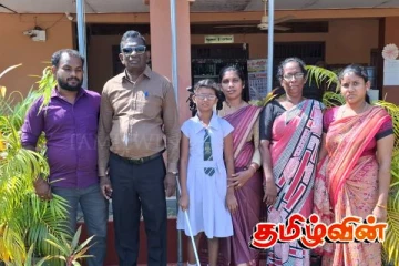 மட்டக்களப்பில் பார்வை இழந்த மாணவி புலமை பரிசில் பரீட்சையில் சித்தி