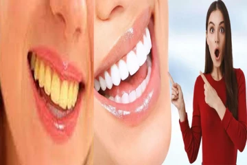 மஞ்சள் நிற பற்களை நொடியில் வெள்ளையாக்க... இத ட்ரை பண்ணுங்க