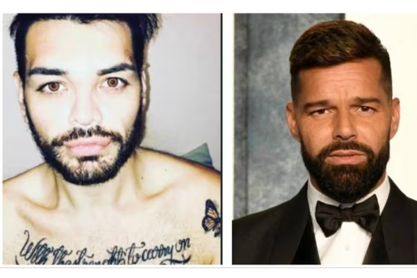 அந்த பாடகரை போல் மாறனும் - 30க்கும் மேற்பட்ட ஆபரேஷன் செய்த இளைஞர்! | Argentina Man Surgeries Like Singer Ricky Martin