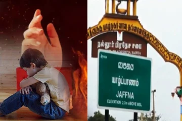 நான்கு வயது சிறுவனுக்கு வாயில் நெருப்பால் சுட்ட ஆசிரியர் - யாழ்ப்பாணத்தில் சம்பவம்