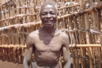 பெண்களை கண்டு பதறி ஓடி ஒழியும் நபர்; விசித்திர நோயால் வியப்பு!